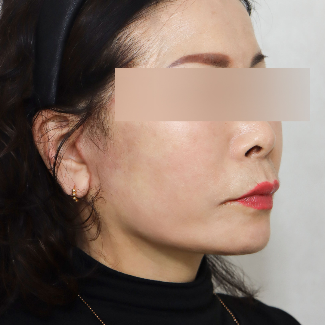 미니거상 after측면 이미지