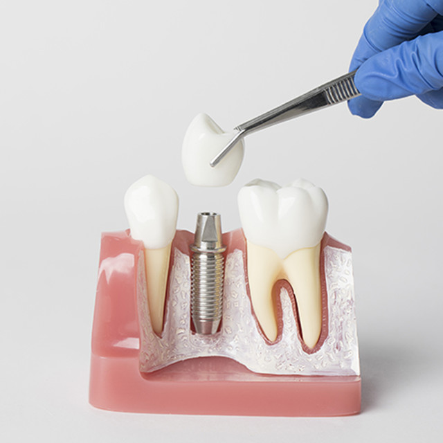 빠른 치료 과정