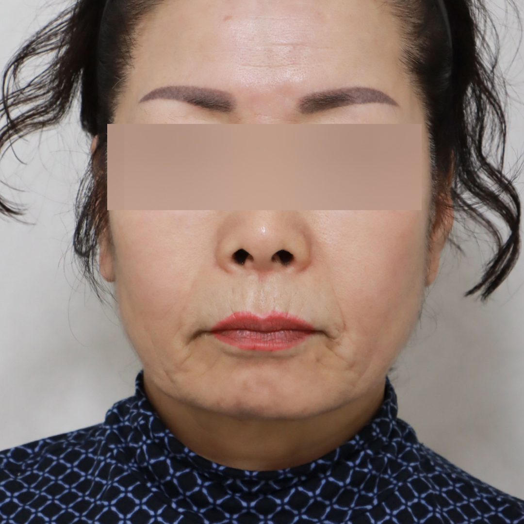 미니거상 before정면 이미지