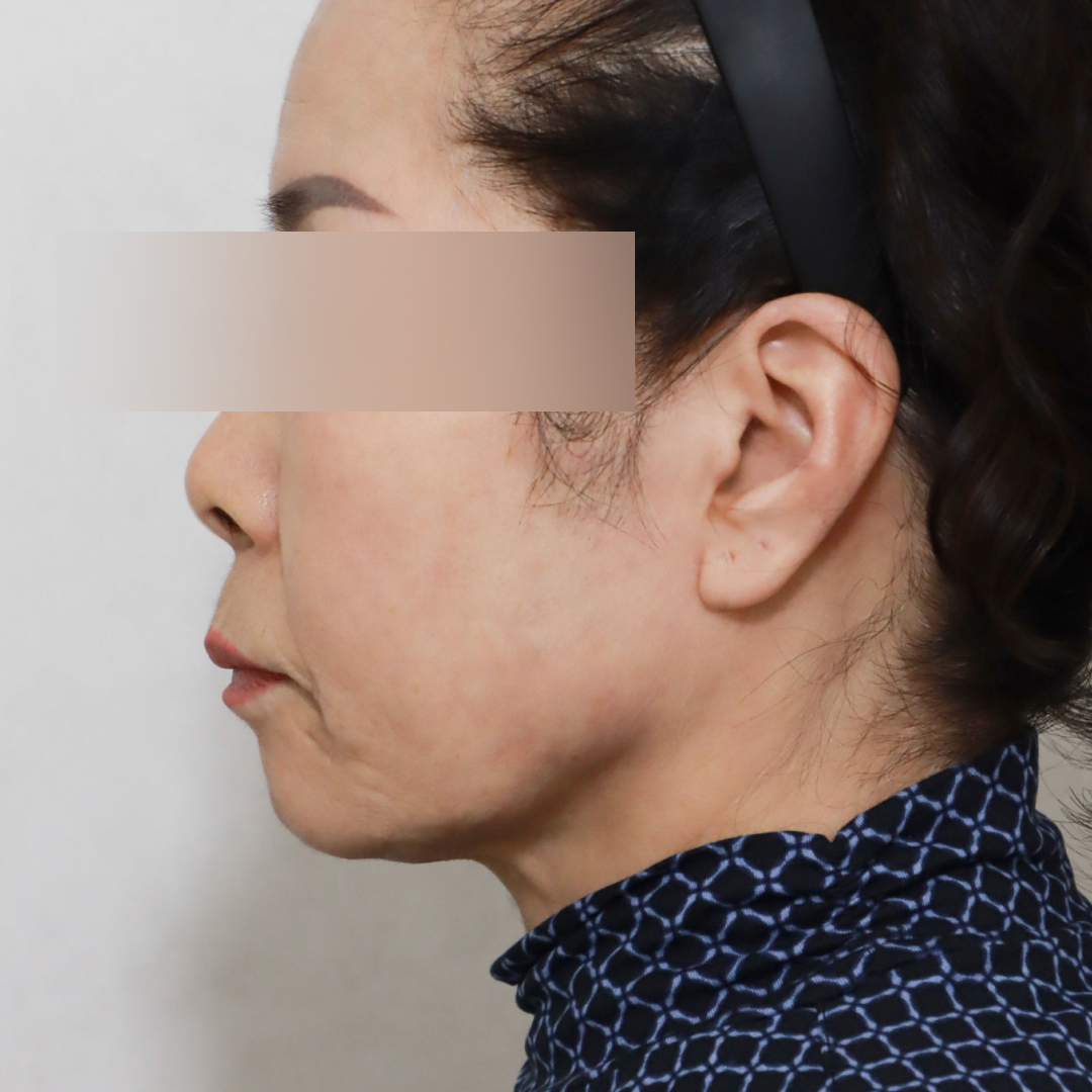 미니거상 before 90도 이미지