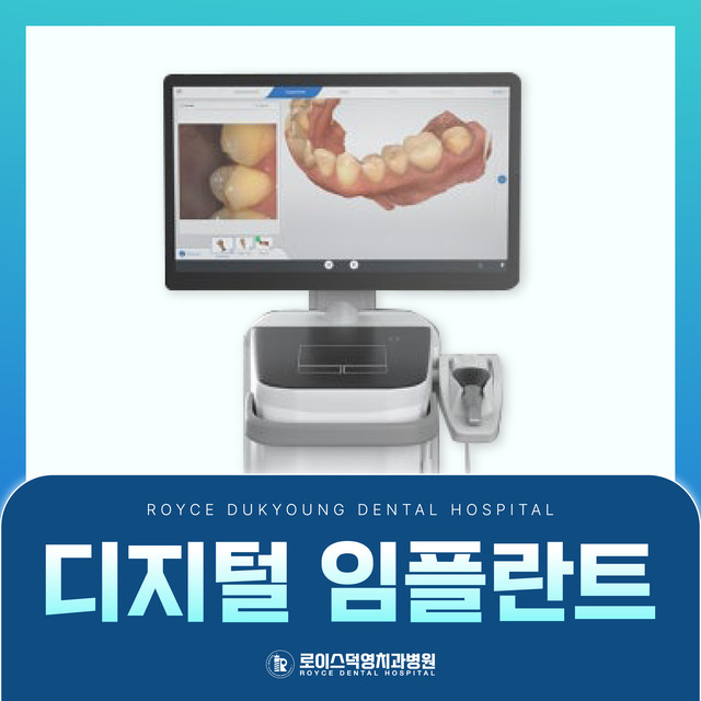 디지털 임플란트