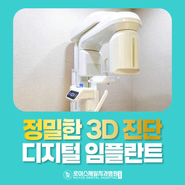 디지털 임플란트