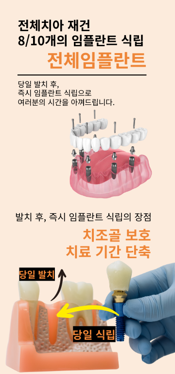 전체임플란트 가격