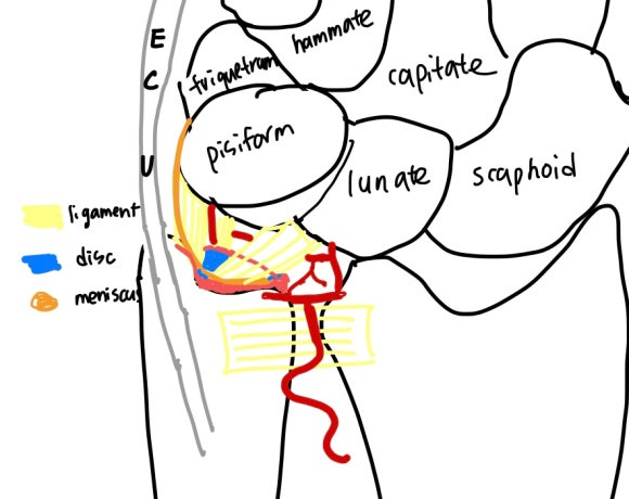 TFCC injury ｜ tfcc 손상 정도, tfcc 구조에 대해서 -1 : 이온한의원