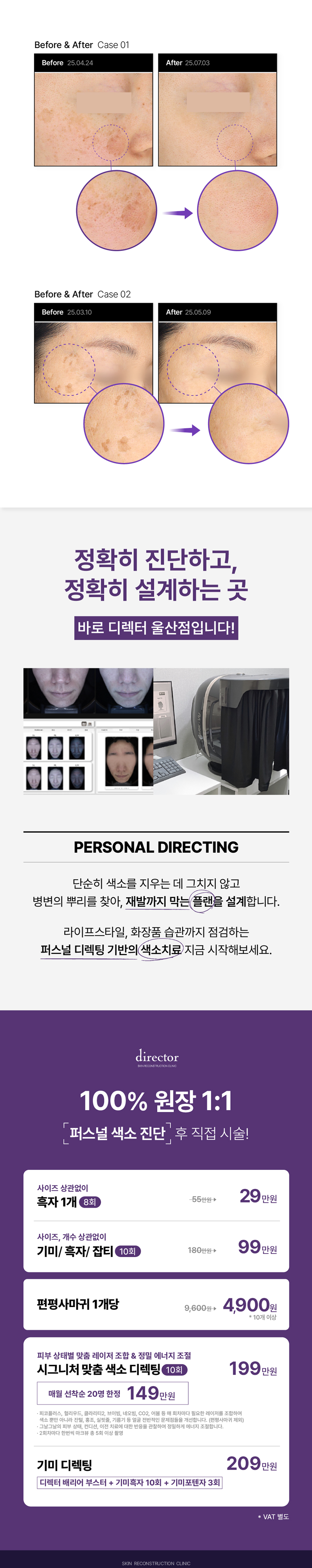 울산 피부과 레이저 복합치료로 기미 잡티 점 제거 