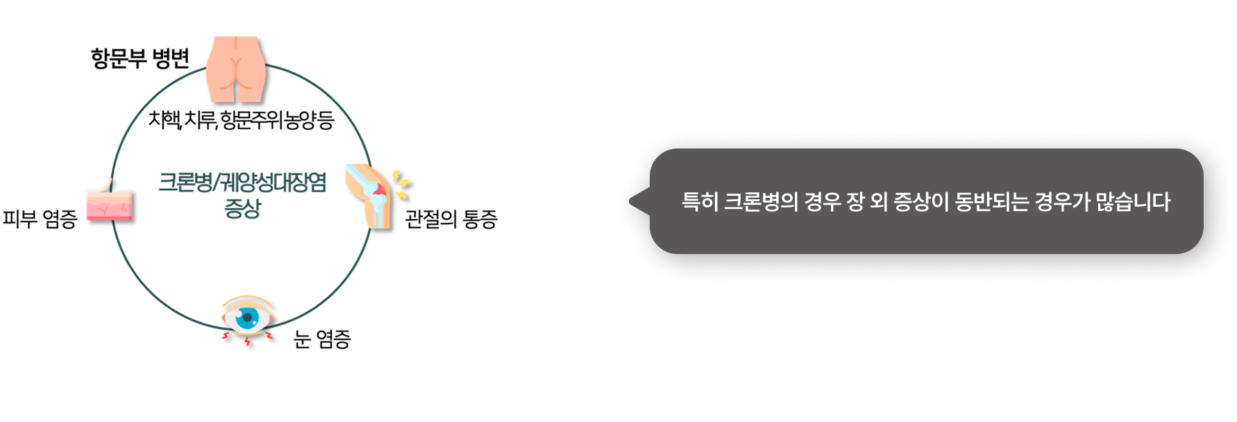 이비엠
