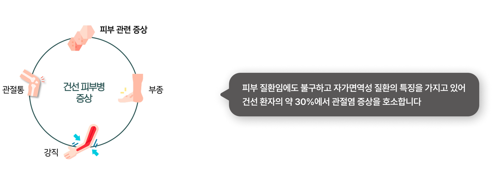 이비엠