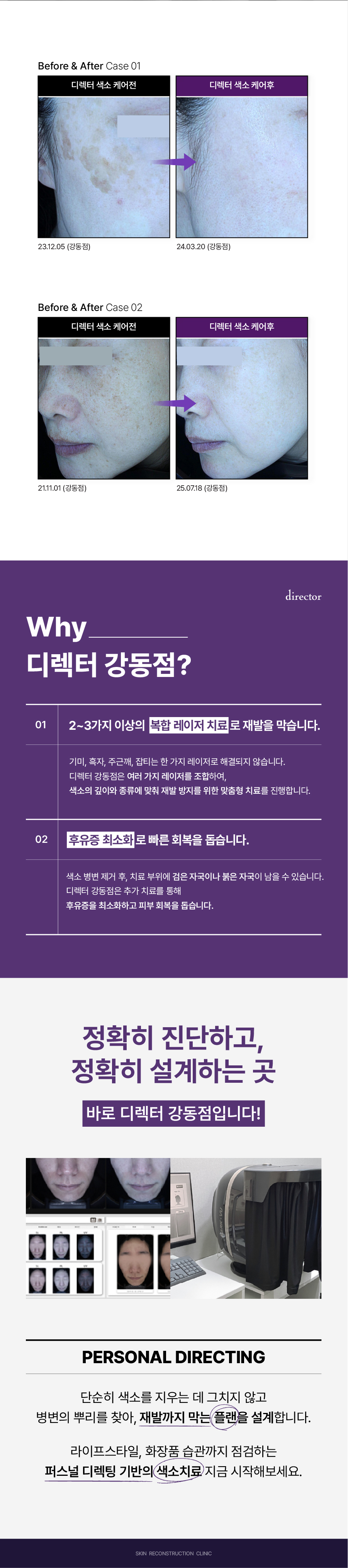 색소올킬 이벤트, 색소 침착, 색소 토닝, 듀얼 토닝, 기미 부스터 