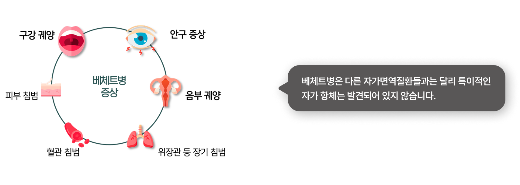 이비엠