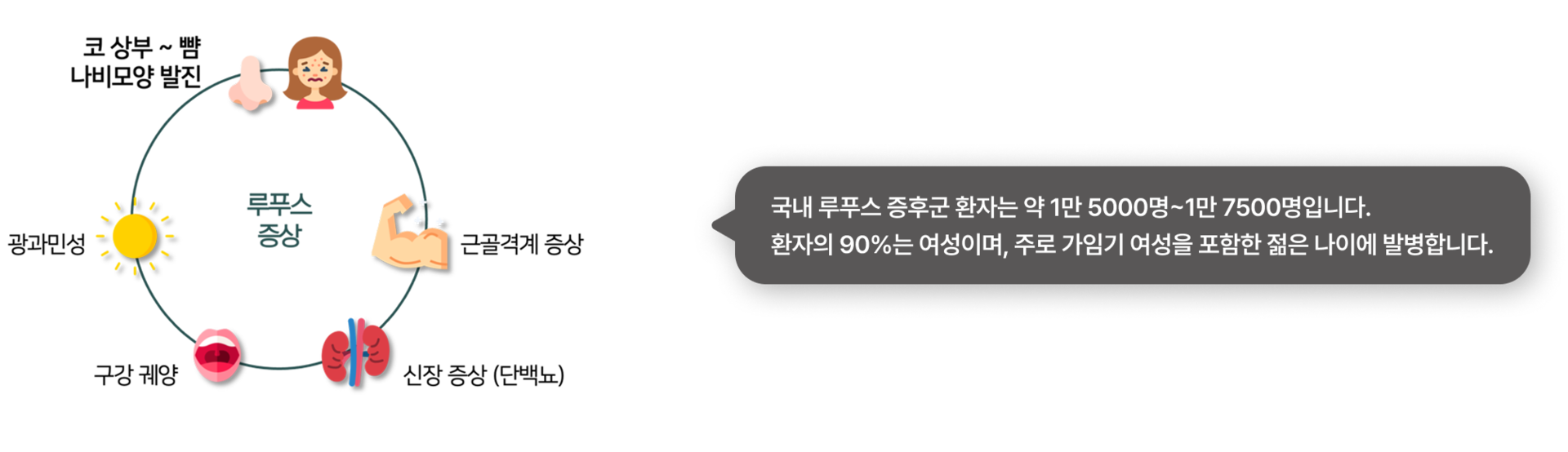이비엠