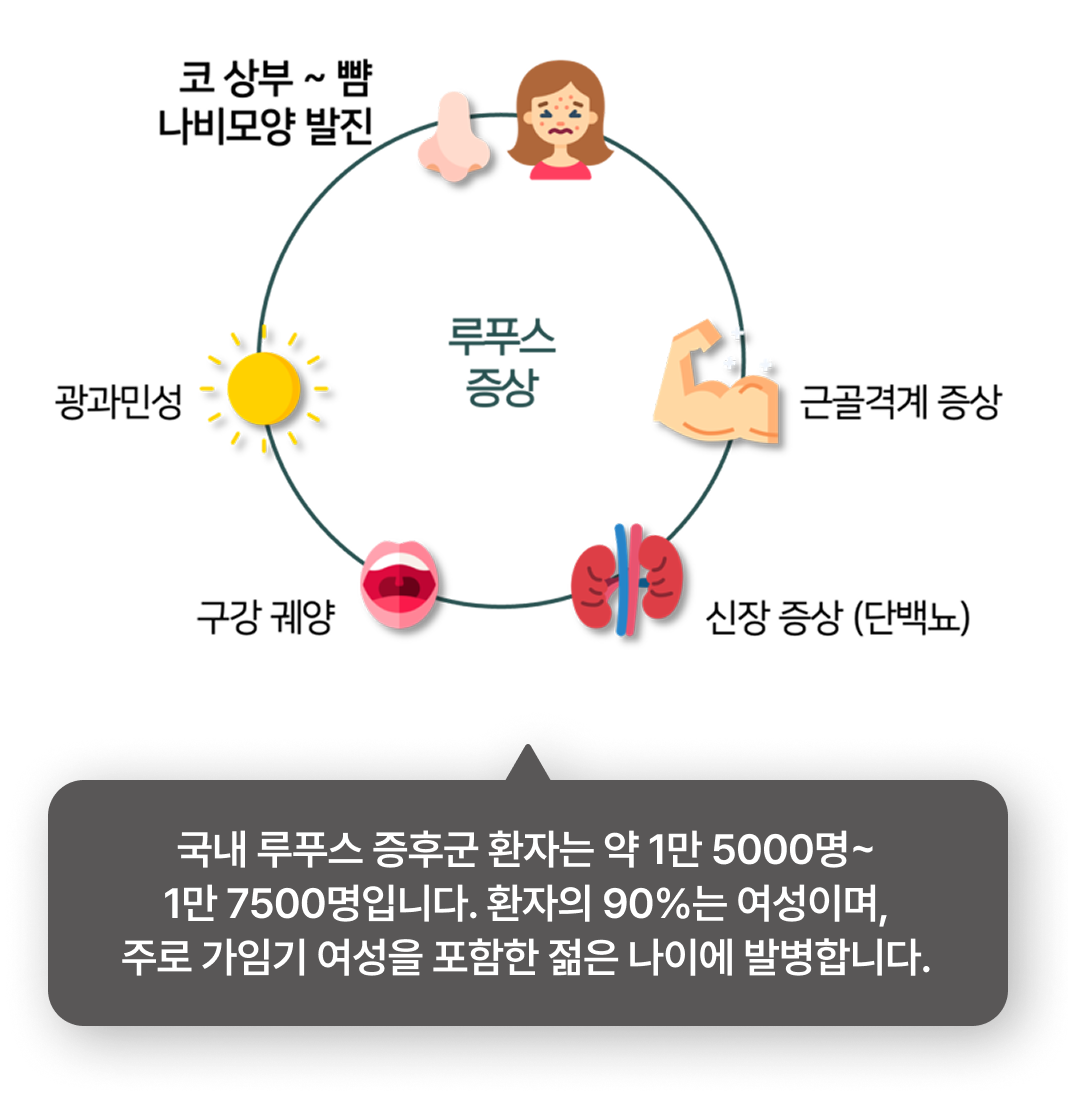이비엠 쇼그렌 증후군