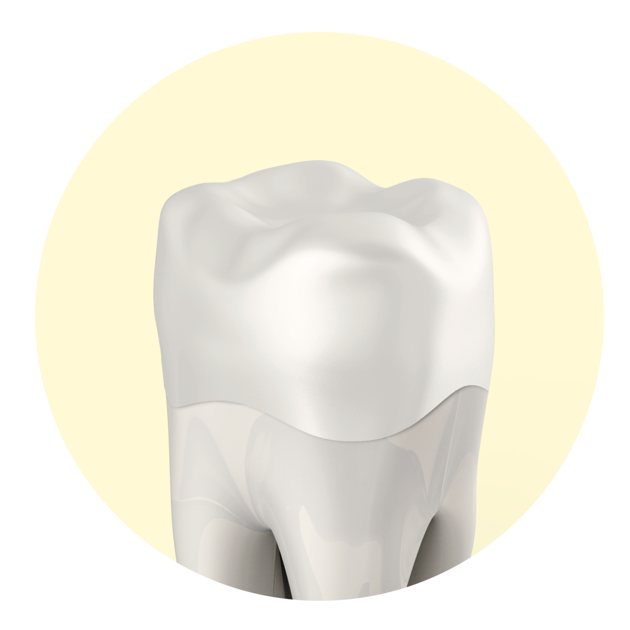 지르코니아 크라운
