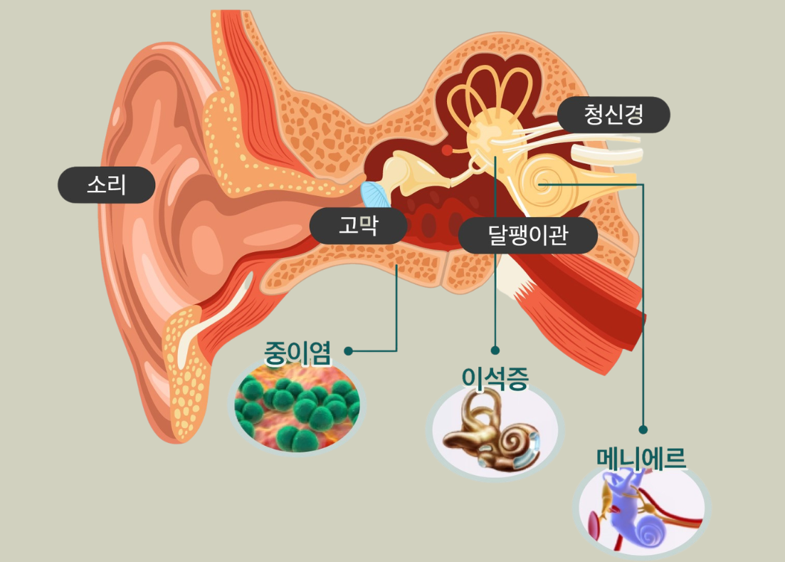 어지럼증 진단