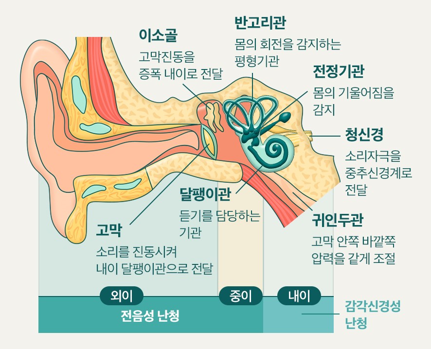난청원인