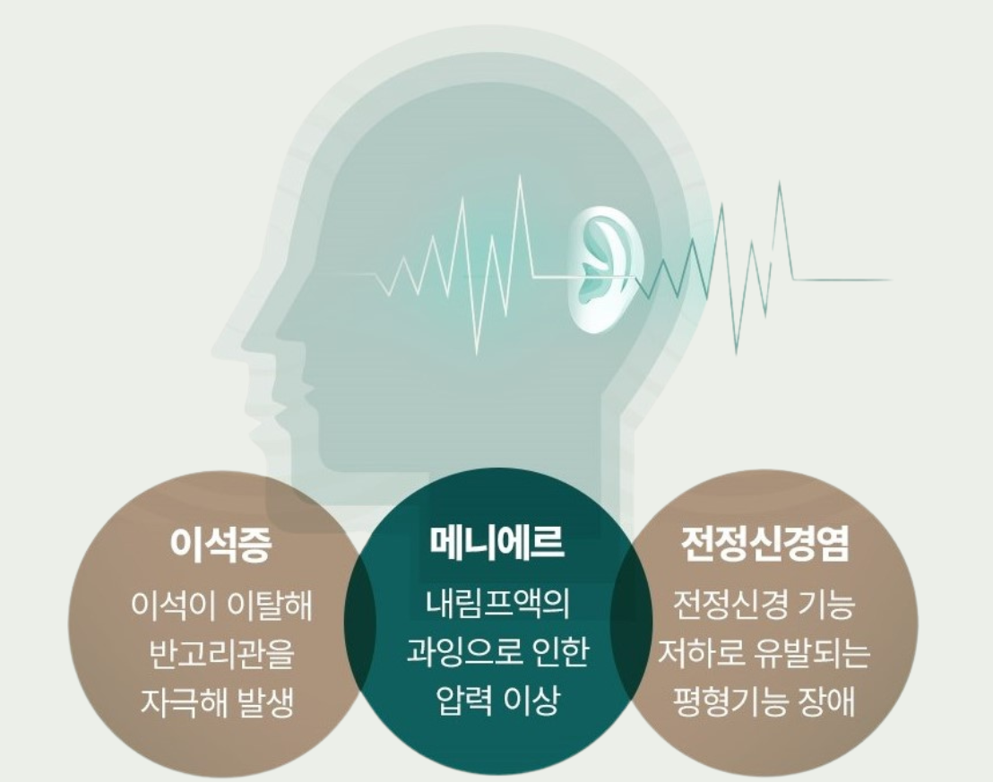 어지럼증원인