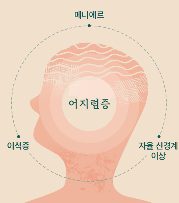 어지럼증