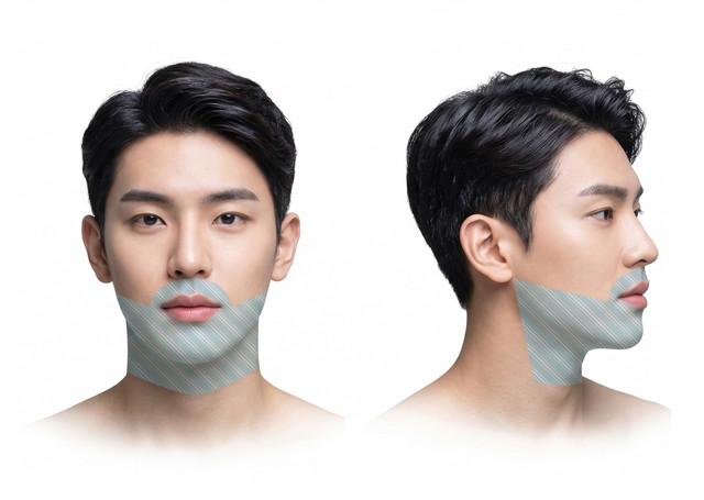 턱 전체 + 인중 남성 레이저 제모 부위 안내