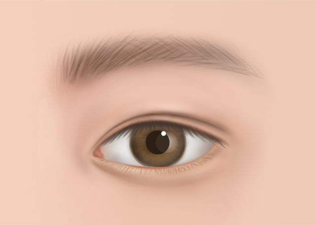 <br><p style="font-size: 20px;">수술후</p>