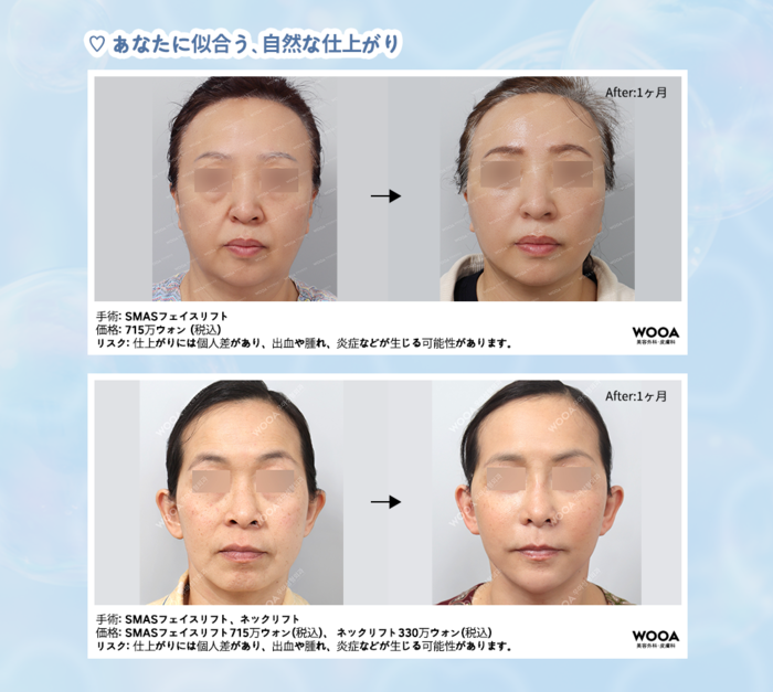 江南の豊胸専門整形外科 WOOA美容外科クリニック
