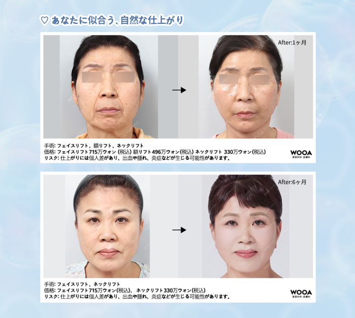 江南の豊胸専門整形外科 WOOA美容外科クリニック