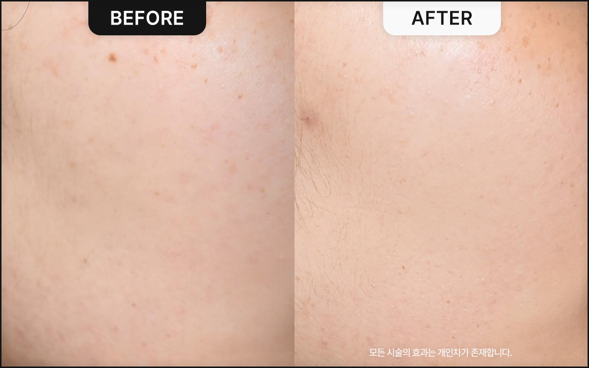 <big><b>감량비책 순</b></big><br><small>30대 여성<br>171.2cm 68.4kg</small>