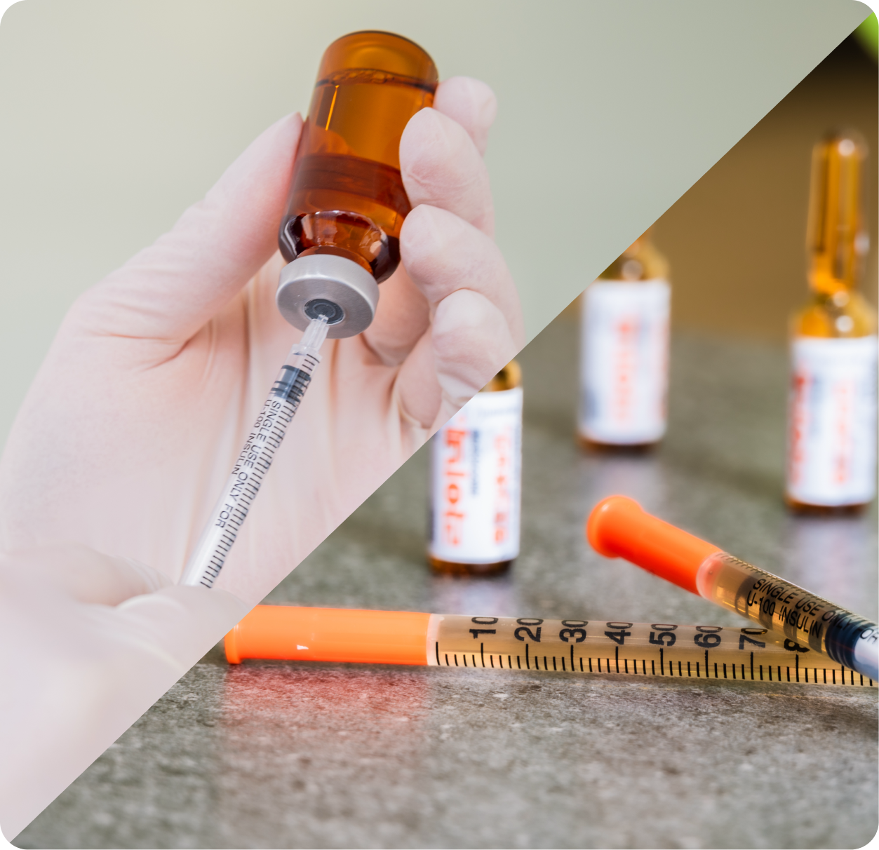 장경인대증후군 2단계의 치료 방법 - 아피톡신(Apitoxin) 또는 라이넥 (Laennec)