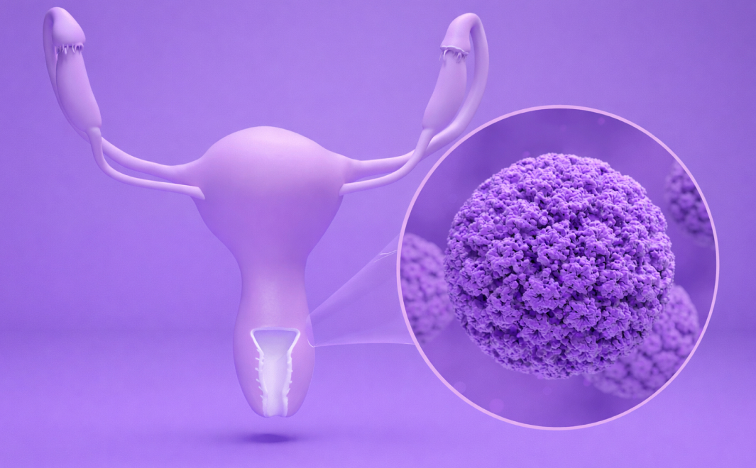 저위험군 HPV (6, 11형 등)