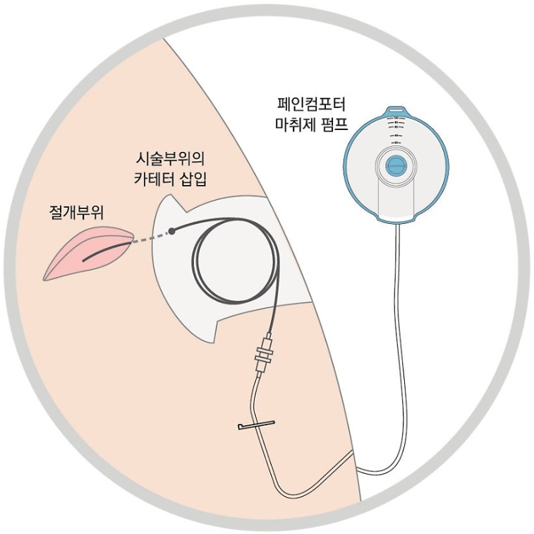 페인컴포터