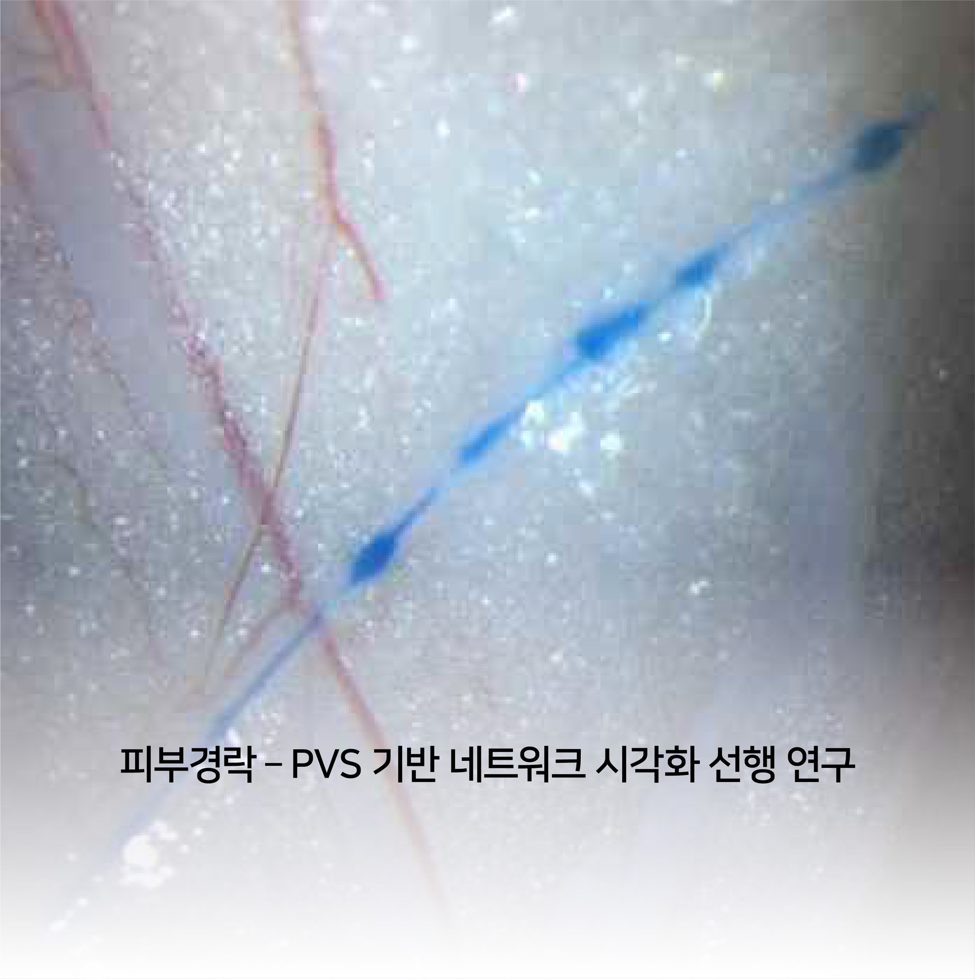 우측 하단 이미지