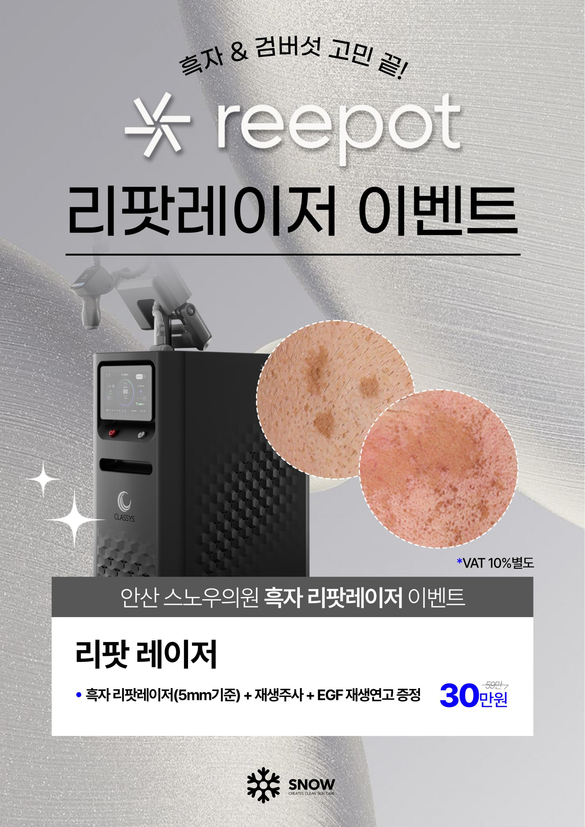 리팟레이저 EVENT