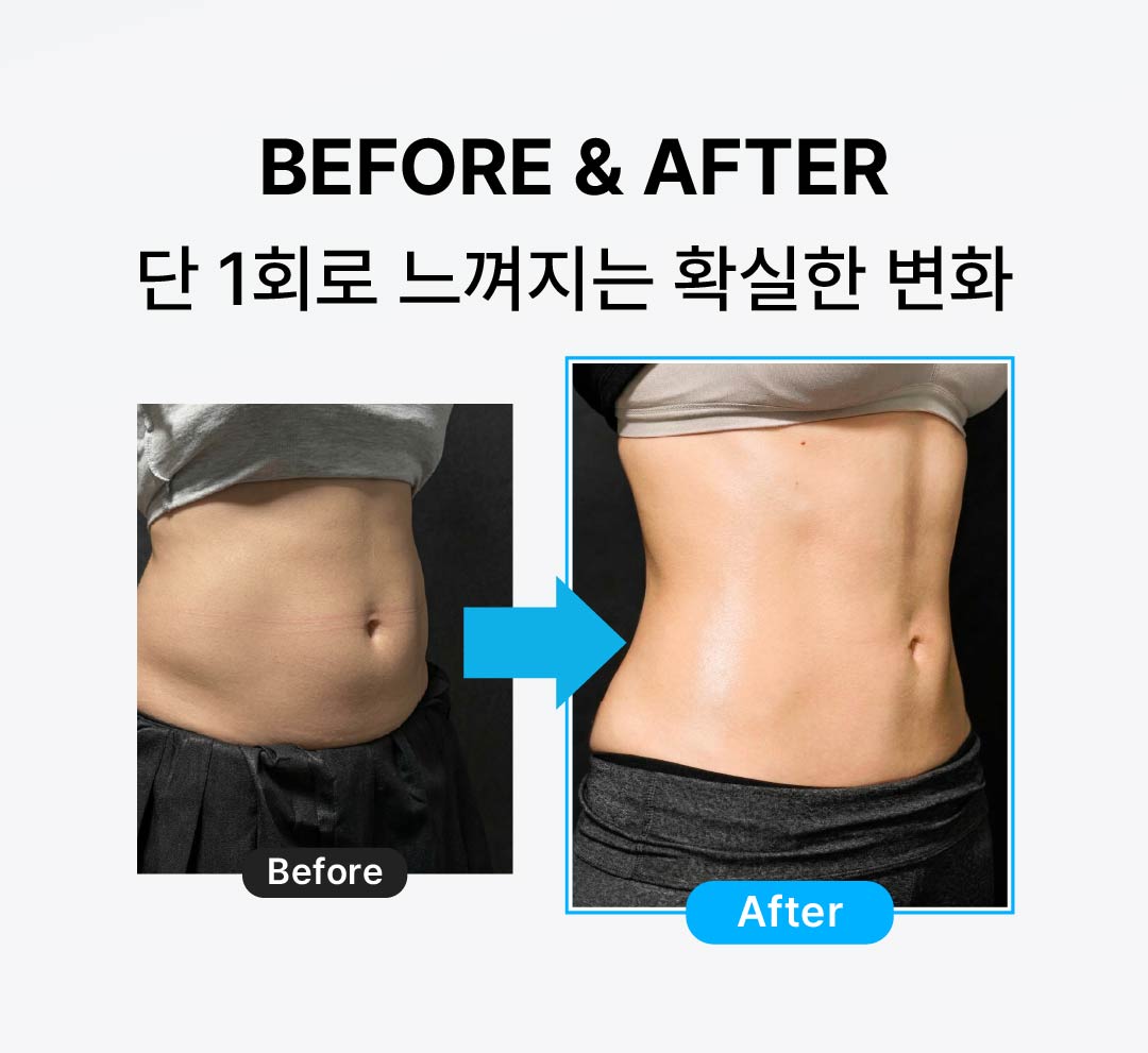 슬리밍 바디 케어 전후 비교 이미지 예시