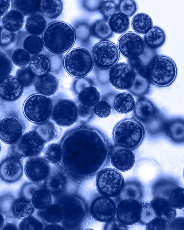 생애주기별 마이크로바이옴