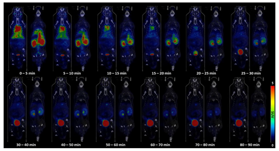 실시간 PET/CT 영상