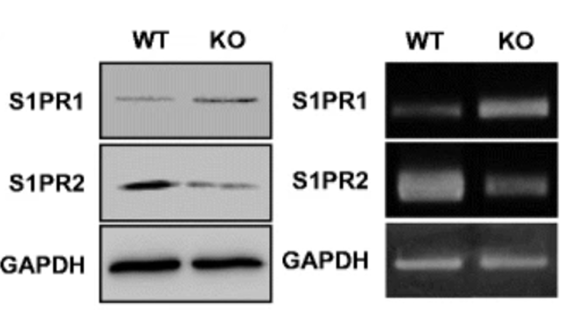  mRNA expression levels of S1PR1 and S1PR2
