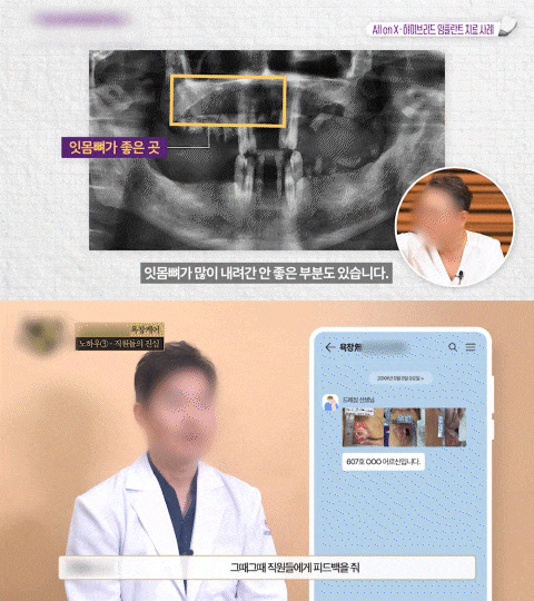 환자 사례를 예시로 보여주는 GIF 이미지