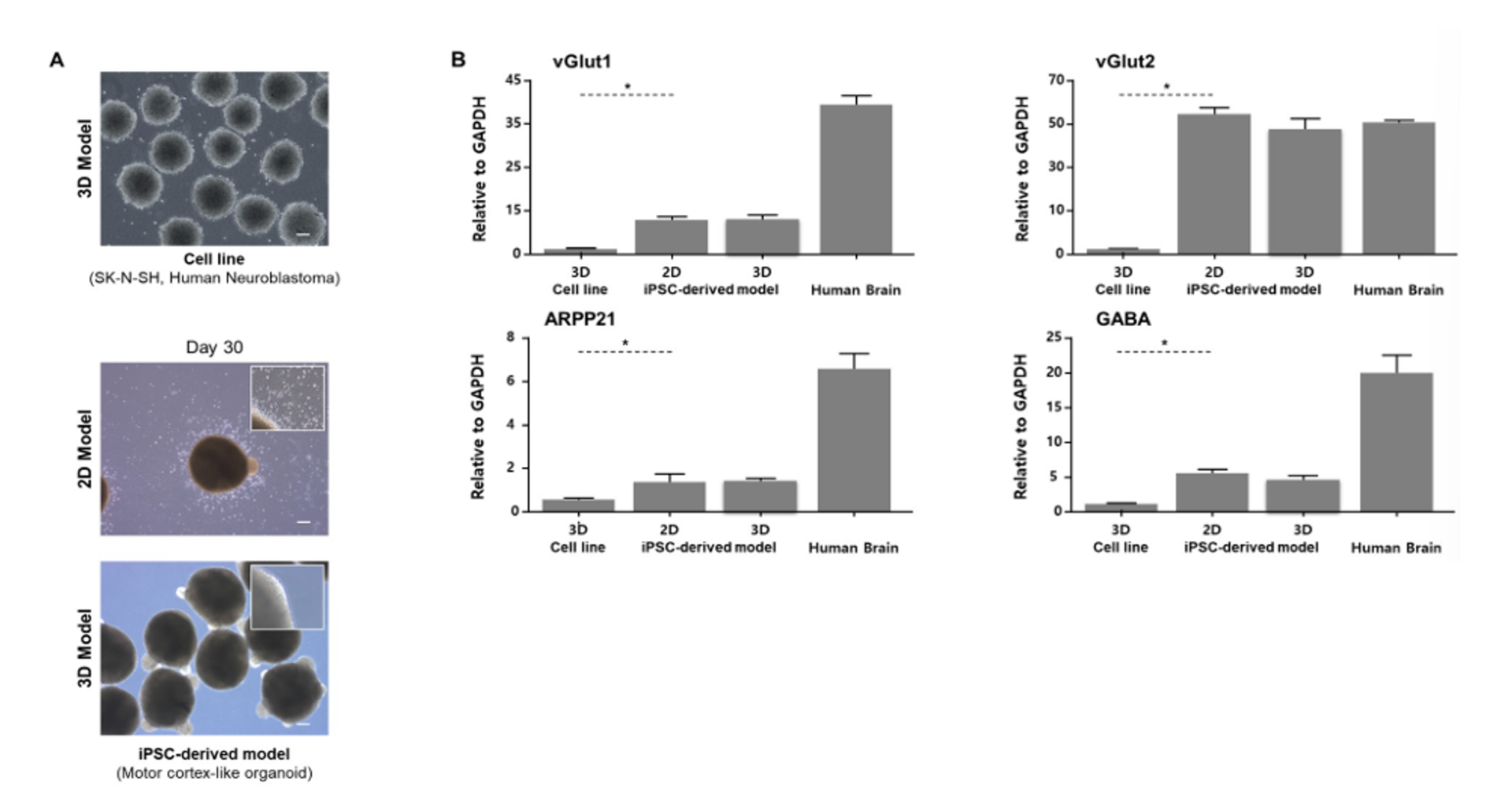 Human Neuroblastoma 암세포주를 사용하여 형성한 오가노이드 결과 예시