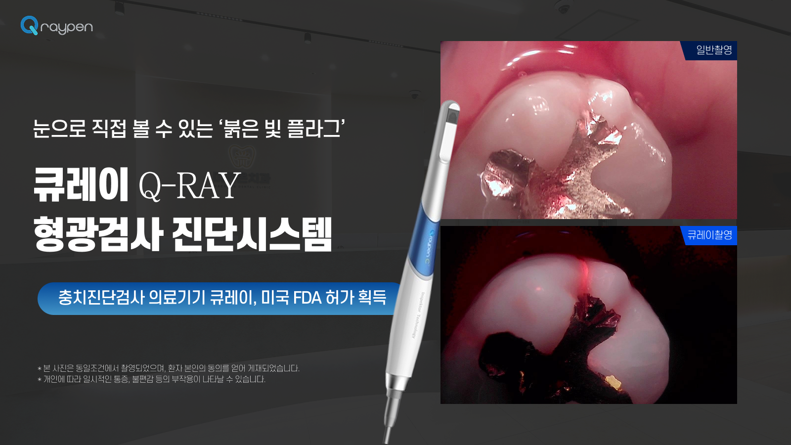 큐레이 Q-RAY 형광검사 진단시스템