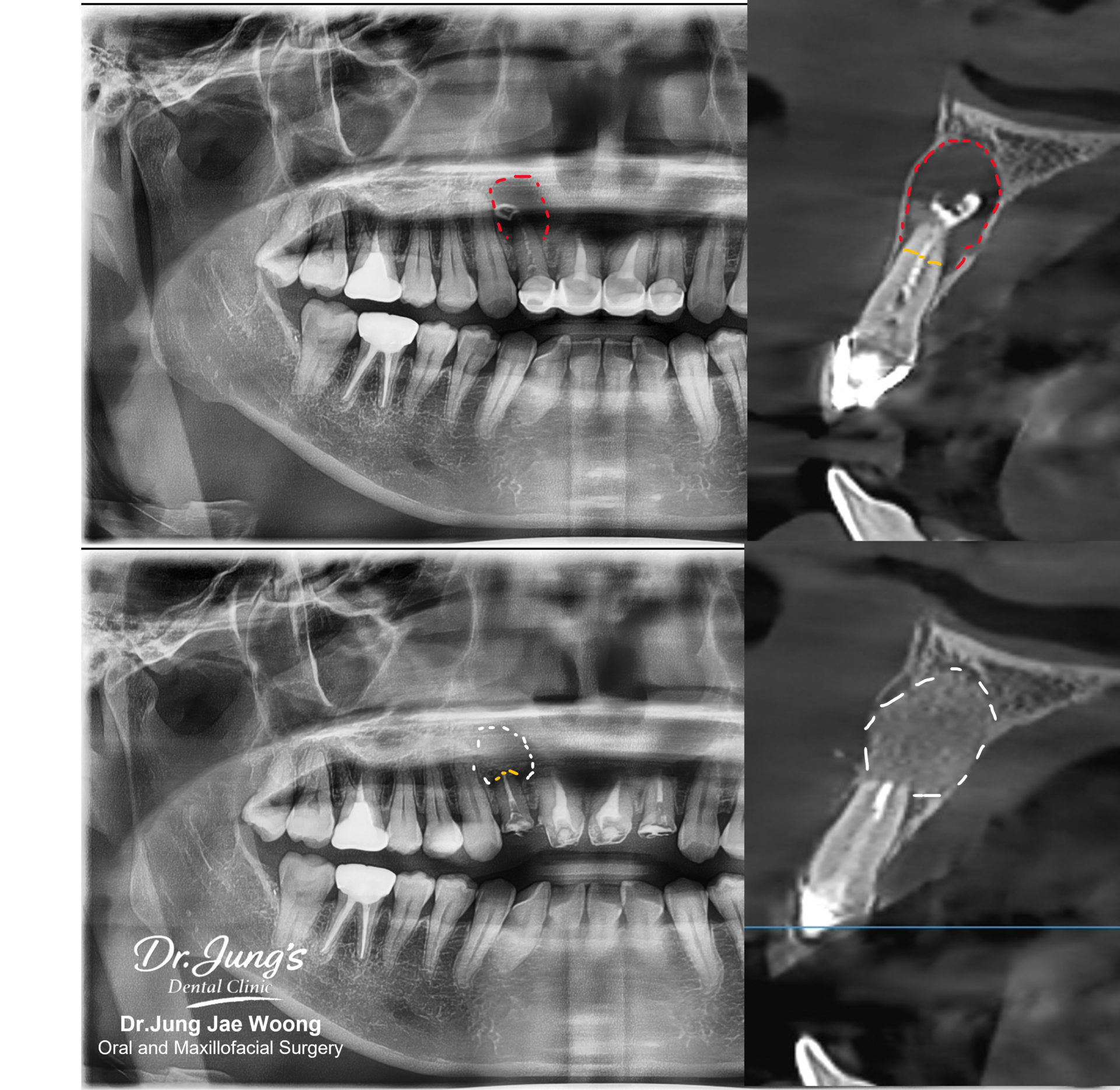 Oral surgery Dr. Jung's Dental Clinic Jeju