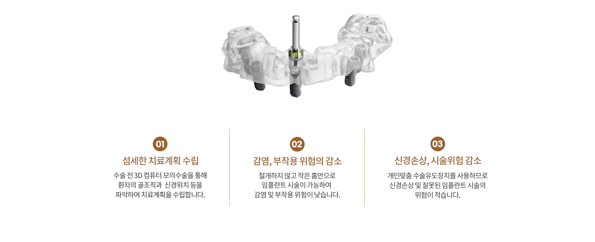 방학역 연세더튼튼치과의 임플란트