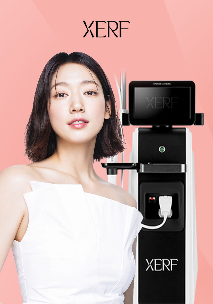 세르프이벤트