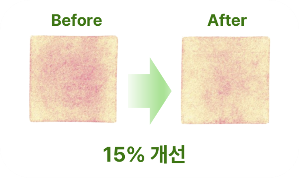 <p><span style="font-size: 16px; color: #387d31;">자극 감소 확인</span></p>