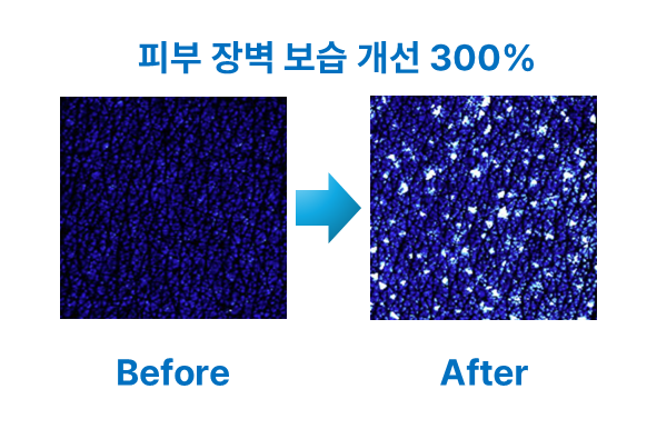 <p><span style="font-size: 16px; color: #0b5394;">피부 장벽 보습 개선 확인</span></p>