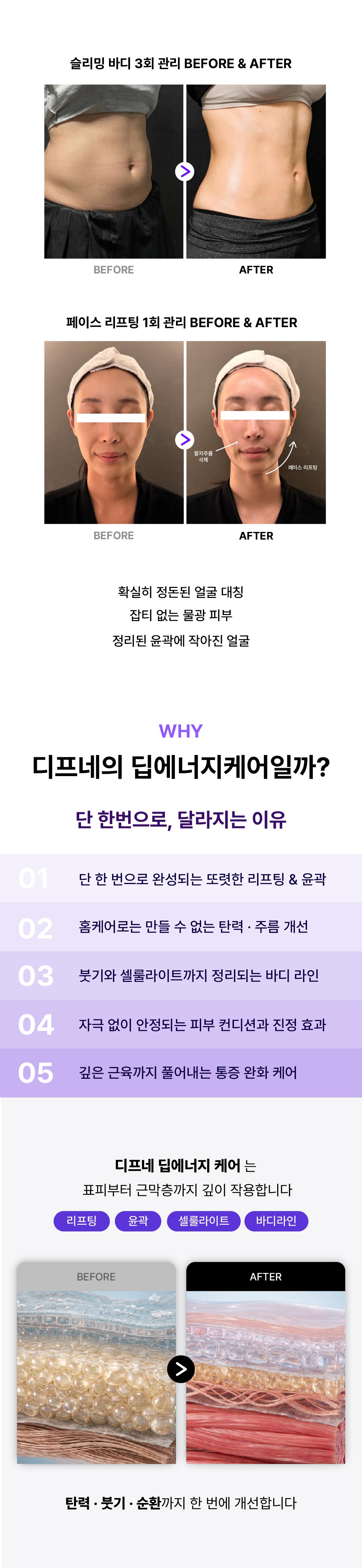 디프네 슬리밍 바디 및 페이스 리프팅 비포 에프터 실제 변화 사례 딥에너지 케어 효과
