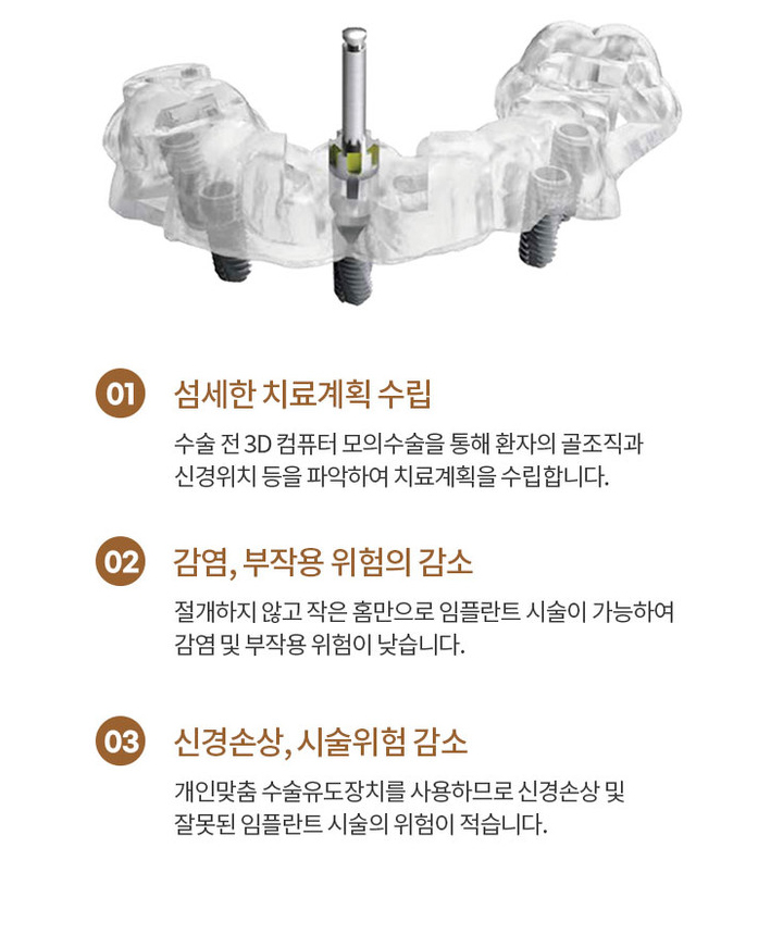 방학역 연세더튼튼치과의 임플란트