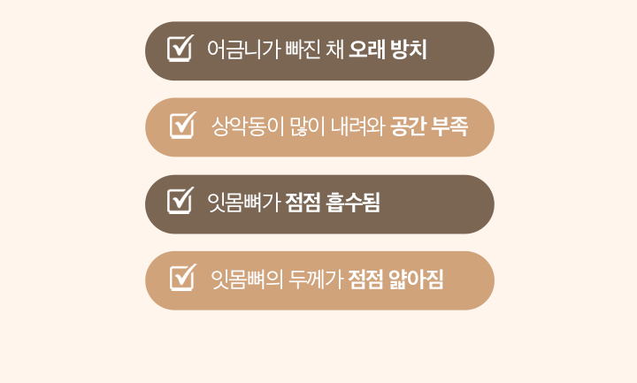 도봉역 연세더튼튼치과 고난도 뼈이식이 필요한 경우