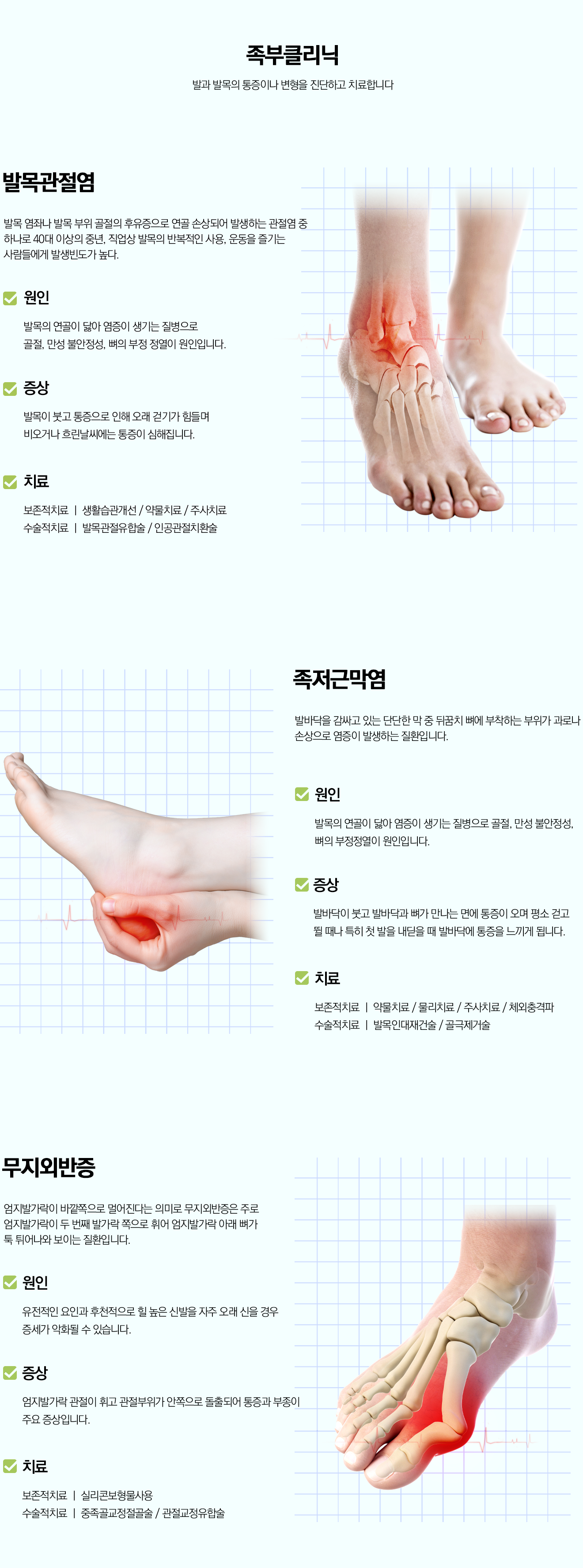 양천구 목동 족부 정형외과 발목통증 치료 - 제이본정형외과