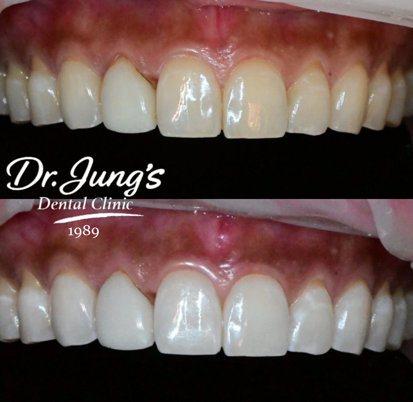 Whitening Dr. Jung's