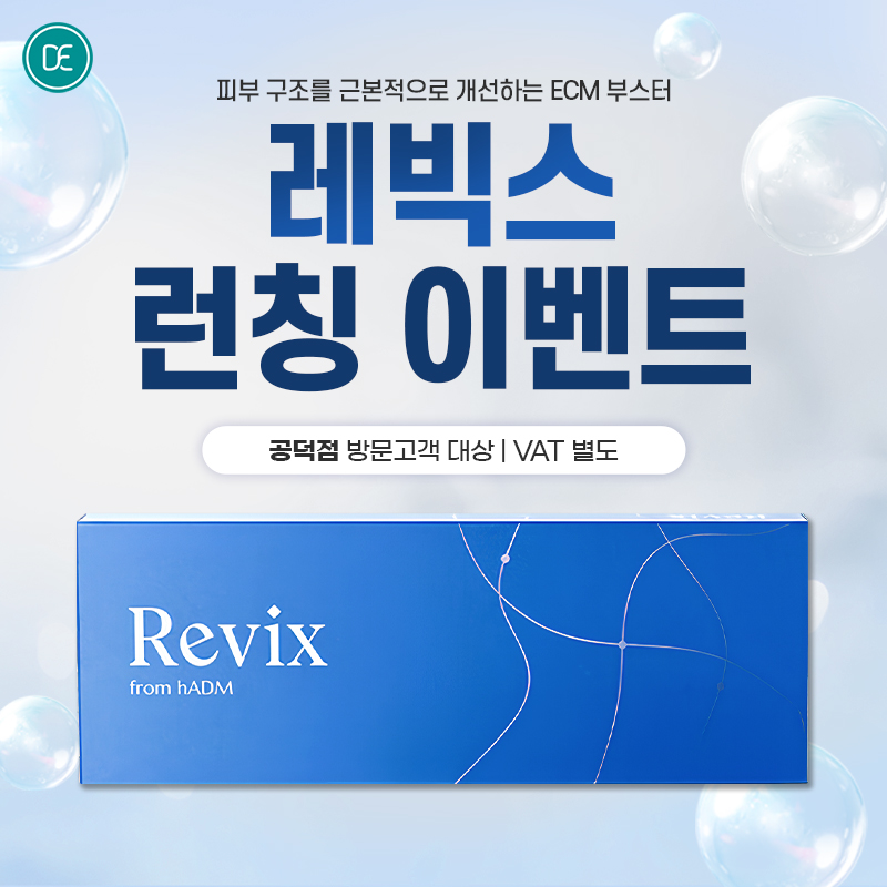 레빅스