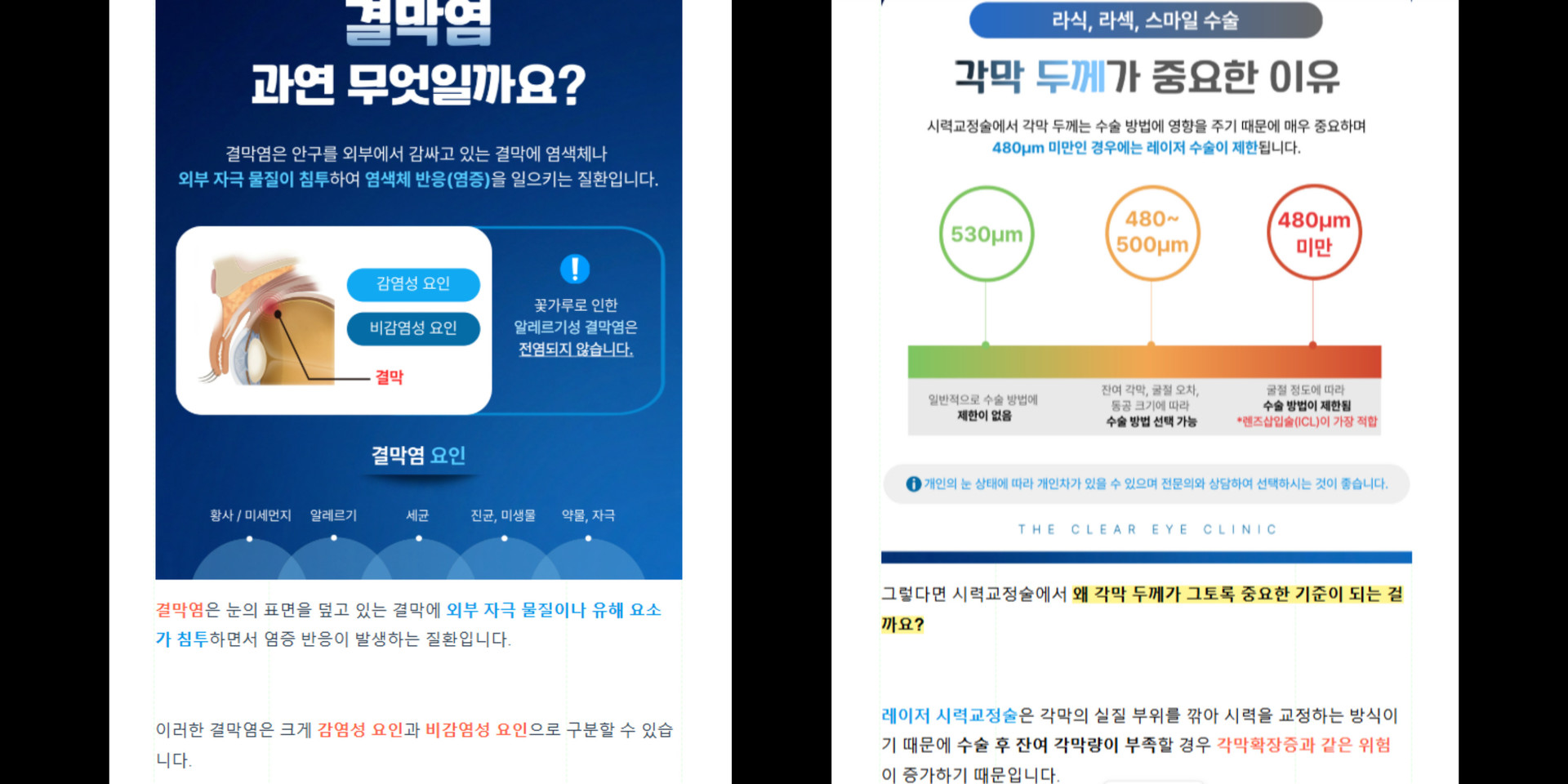 안과 병원블로그 콘텐츠 제작 포트폴리오 - 결막염과 시력교정 수술 정보를 환자가 쉽게 이해할 수 있도록 시각화한 마케팅티처의 실제 의료 콘텐츠 제작 사례