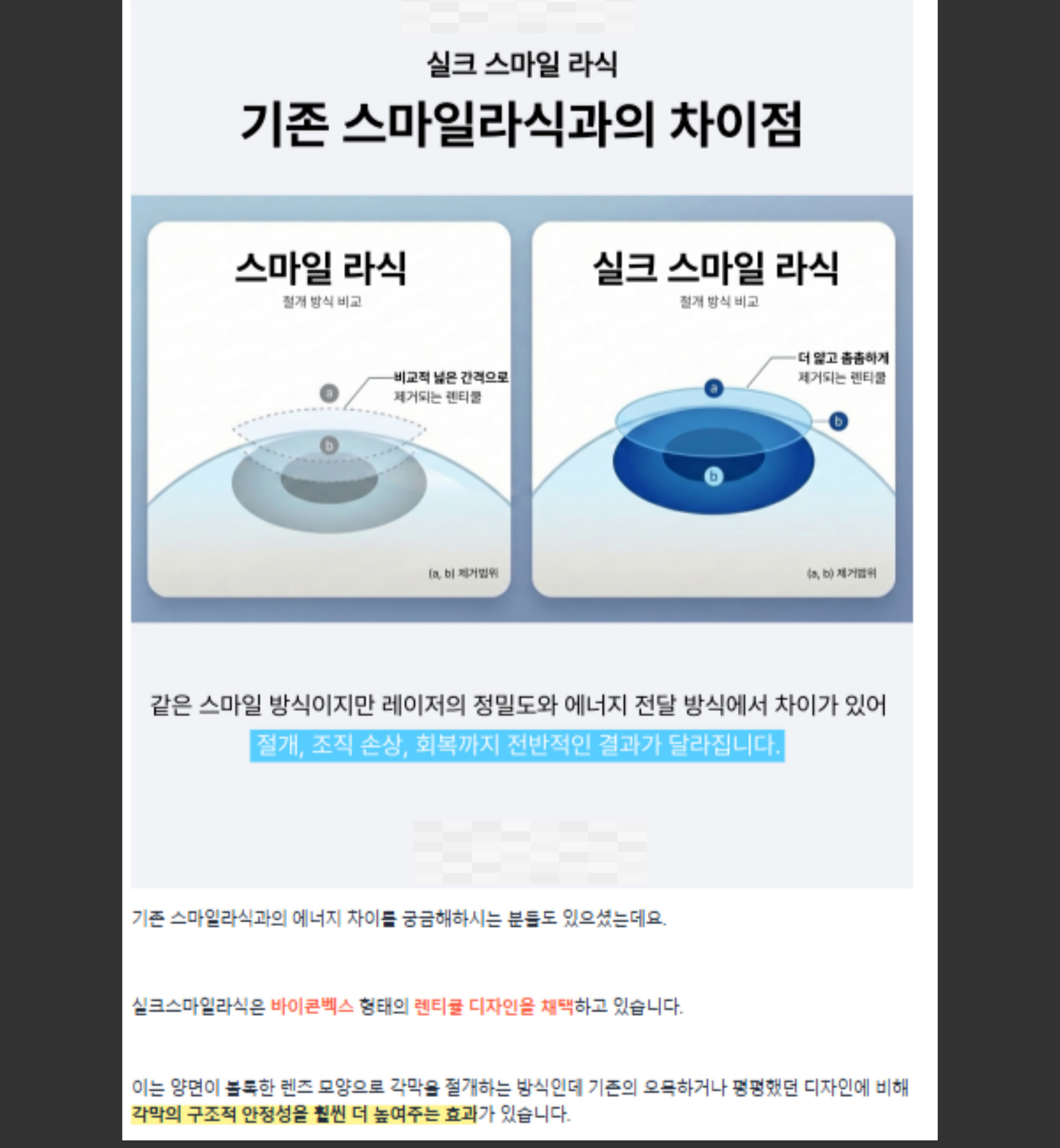 병원블로그 콘텐츠 제작 포트폴리오 - 실제 안과 실크스마일라식 비교 포스팅 사례를 통해 마케팅티처의 병원마케팅 의료 콘텐츠 제작 역량을 보여주는 이미지